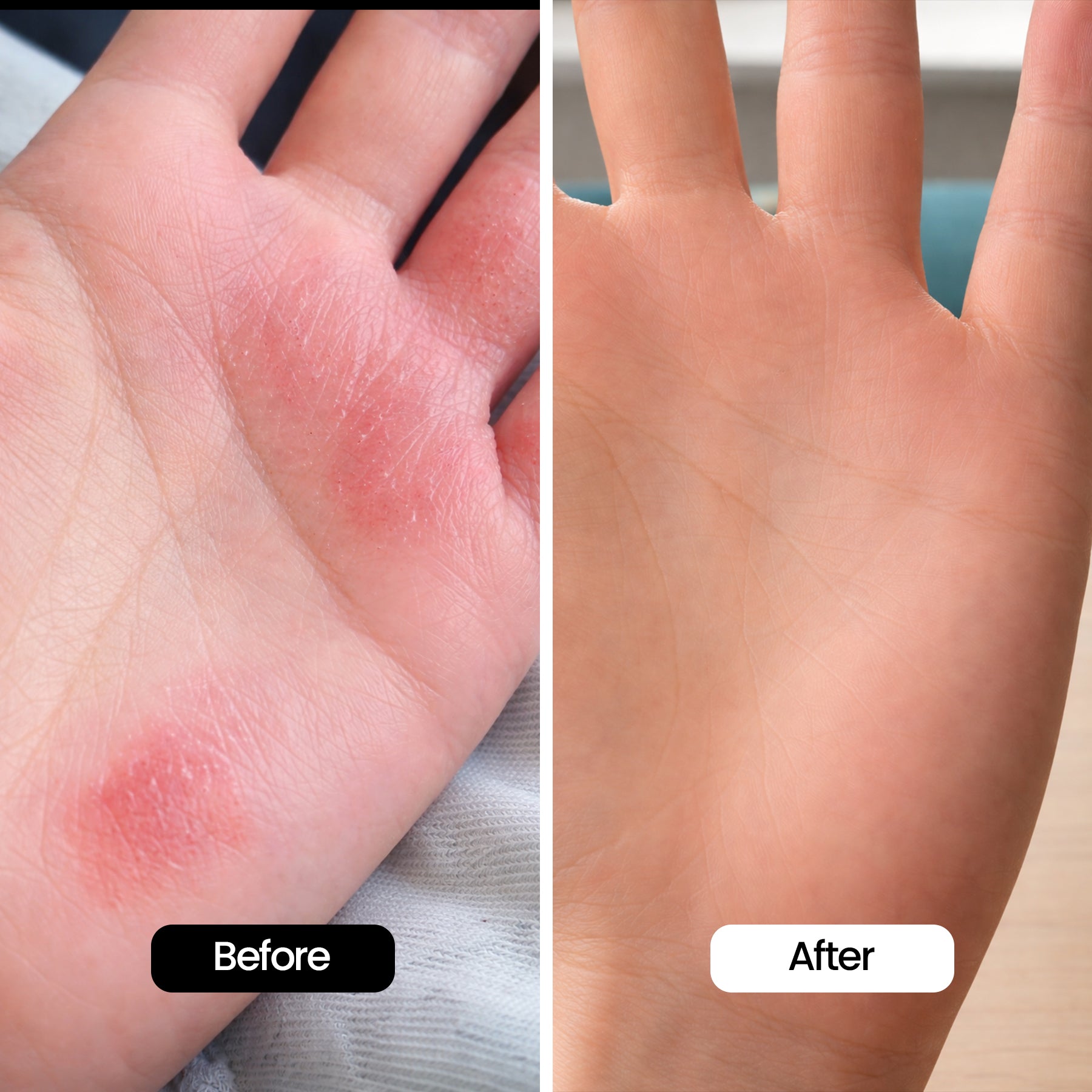 LUME Red Light Therapy Gloves